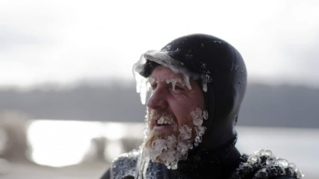 Exostosis and surfing: how to protect your ears from cold and infection? 🌊👂❄️